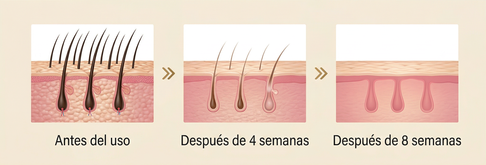 Proceso de debilitamiento del vello