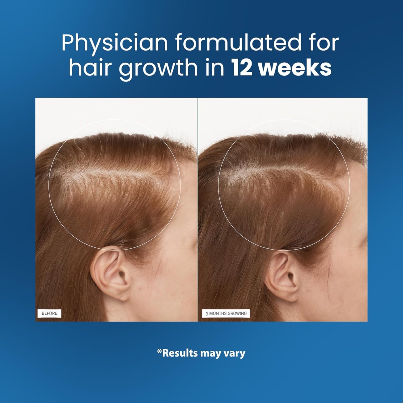 BODYWISE HAIR GROWTH  10ML
