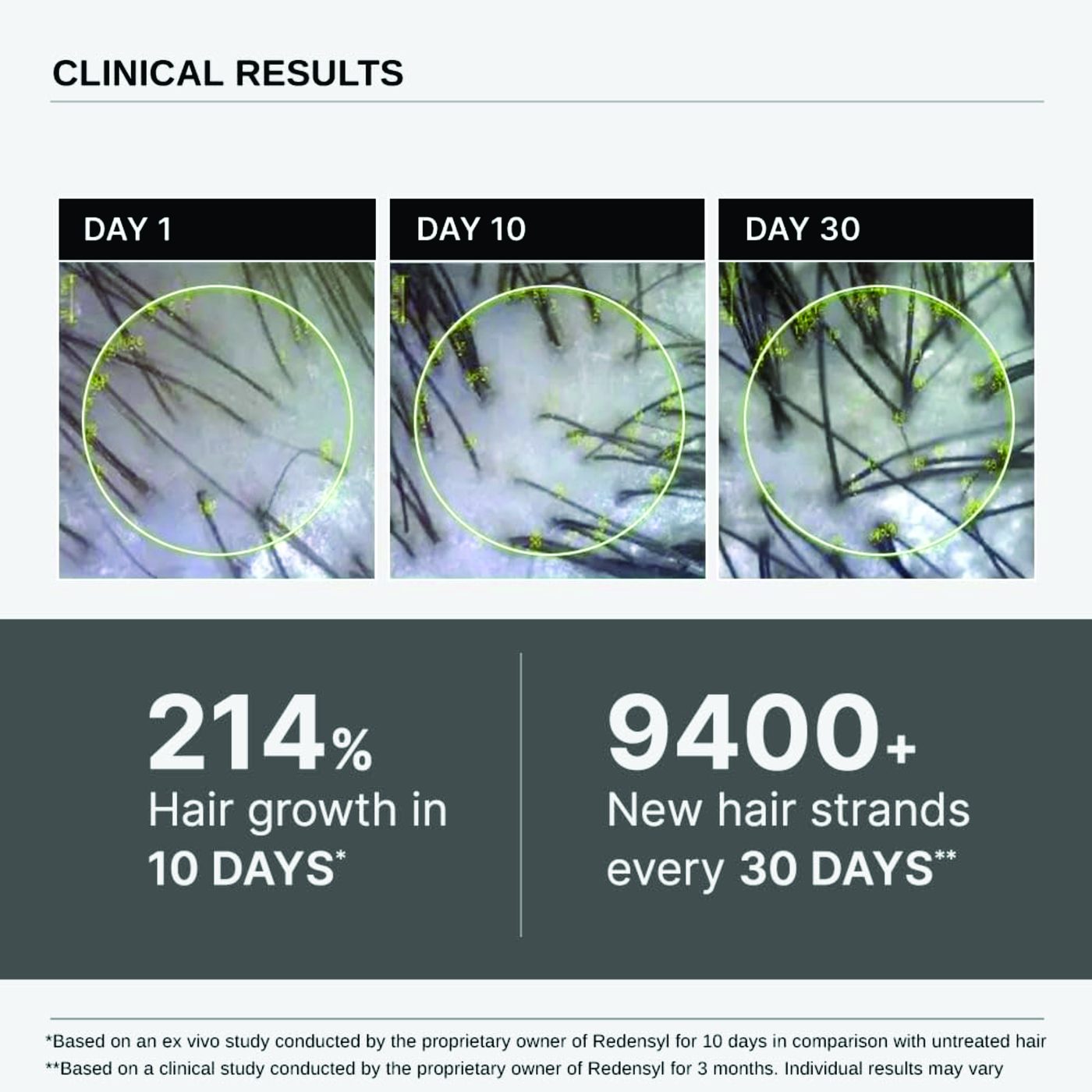 BARE ANATOMY HAIR GROWTH 30ML
