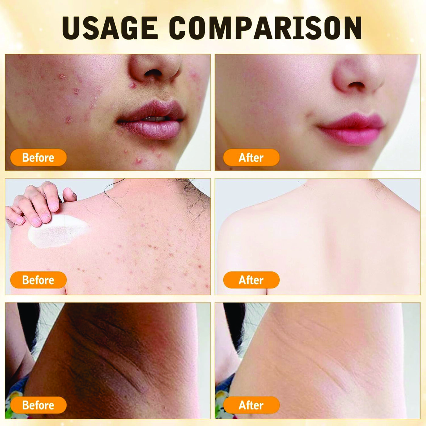 BEEVENOM CREMA RESTAURADORA 60ML