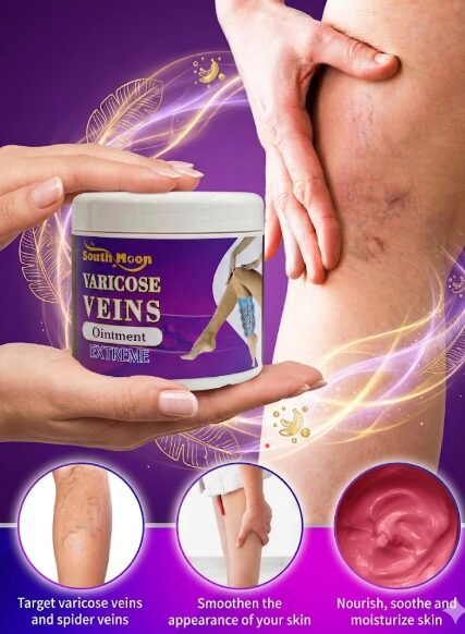 VARICOSE VEINS 50ML