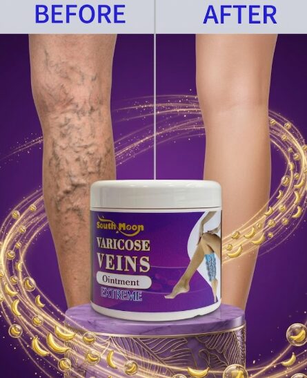 VARICOSE VEINS 50ML