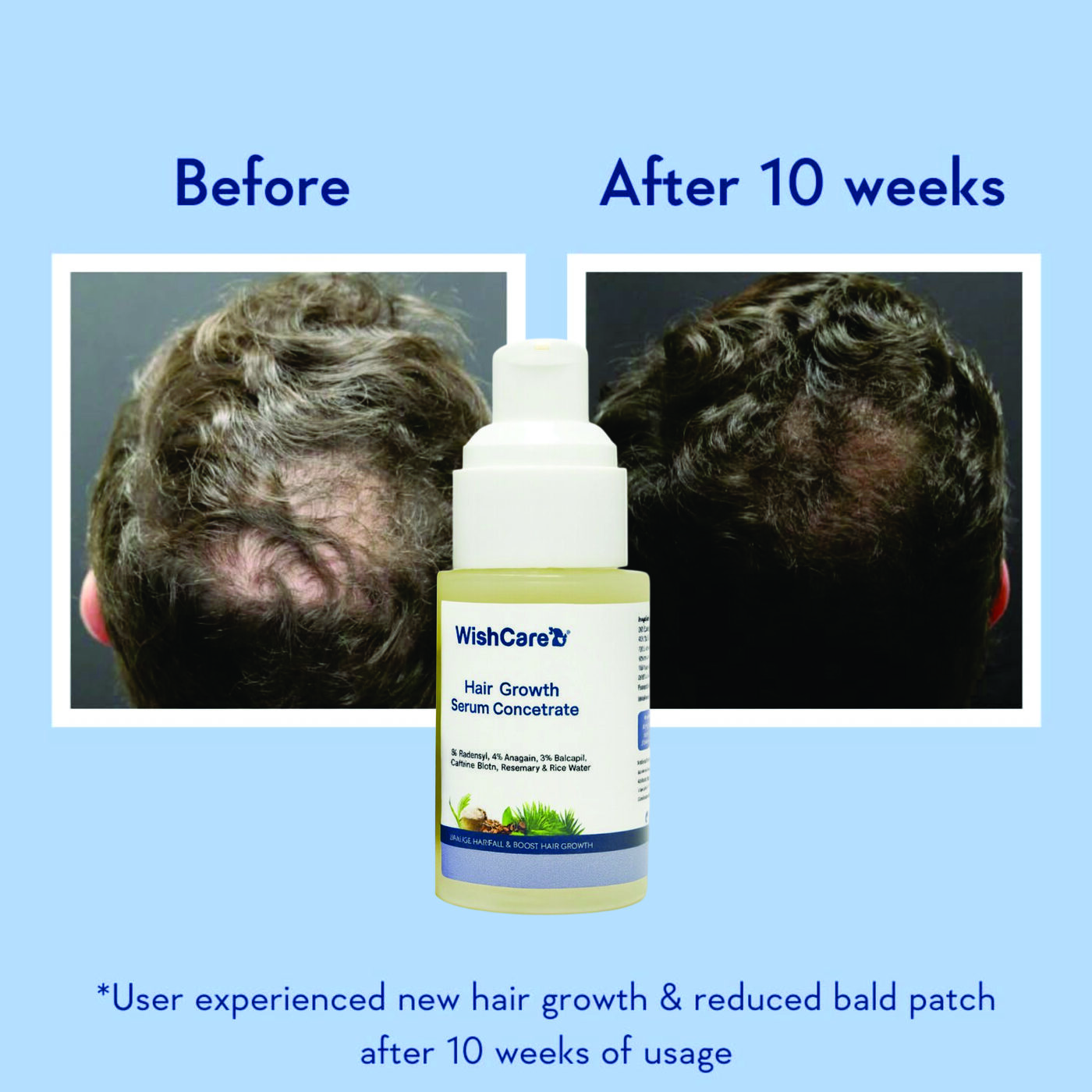 WISHCARE HAIR GROWTH 30ML