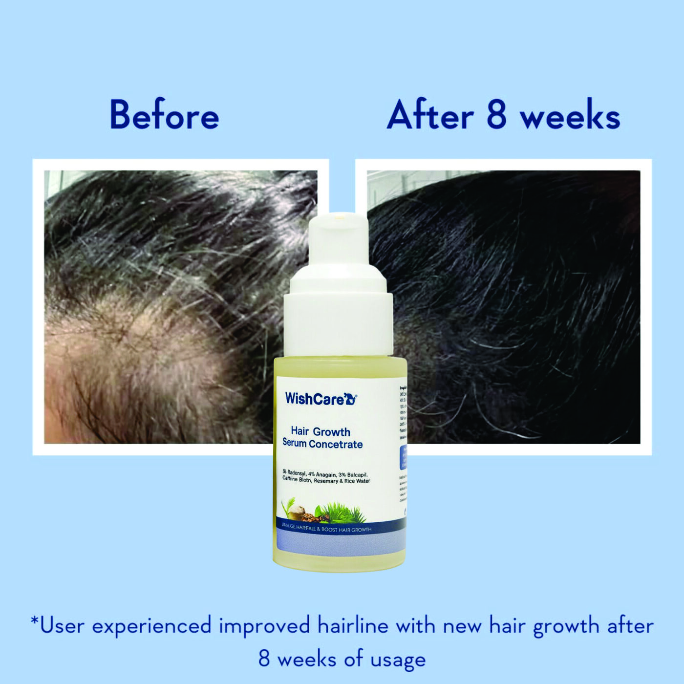 WISHCARE HAIR GROWTH 30ML