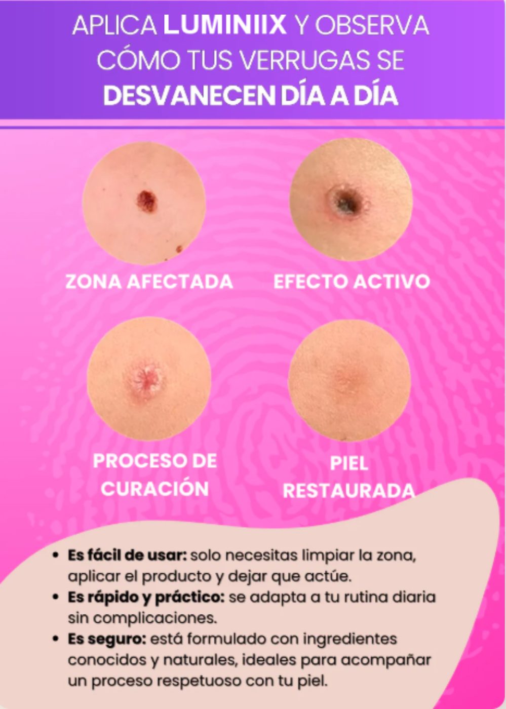 LUMINIIX ELIMINADOR DE VERRUGAS 30ML