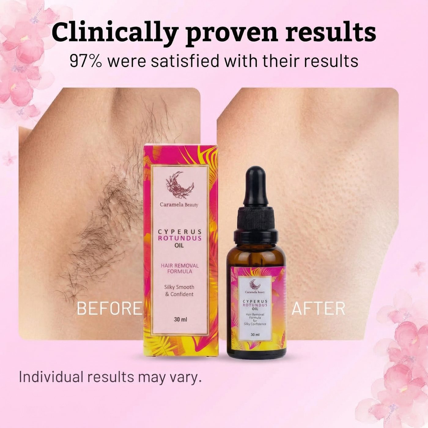 KIT. 2U CYPERUS ROTUNDUS OIL 30ML